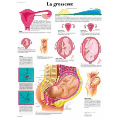Planche anatomique - La grossesse