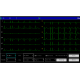 Electrocardiographe ECG Contec 600G (6 pistes) avec interprétation