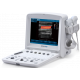 Echographe portable à ultrasons Edan U50