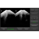 Bladder scanner / Scanner vésical Vitascan DP